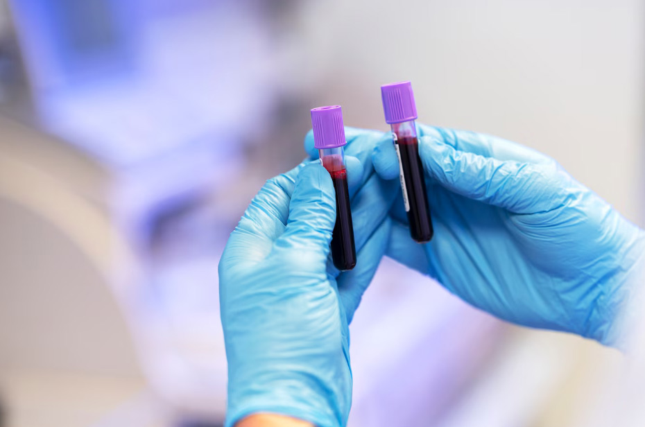 Blut ist nicht gleich Blut – mRNA-Spuren in Spenderblut