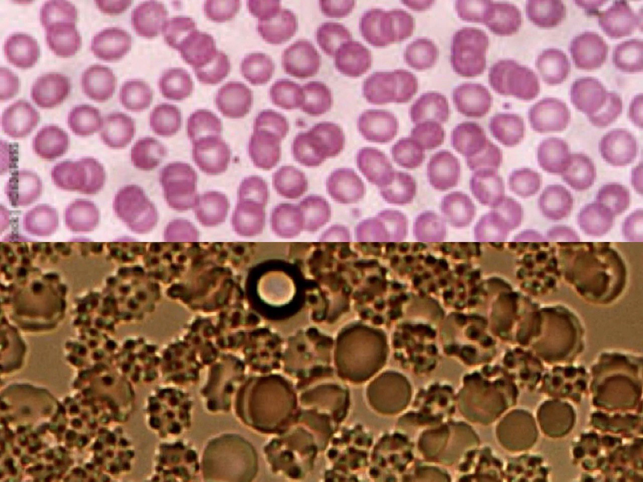 vaxxed-blood-3 Geimpftes Blut