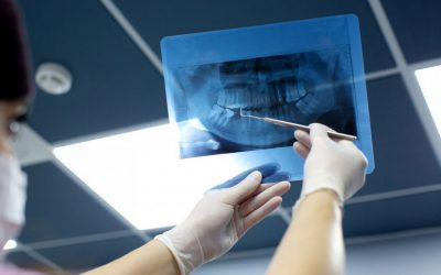 Gifte im Mund – Metalle, tote Zähne und das unsichtbare Risiko